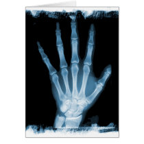 Blue X-ray Skeleton Hand Cards