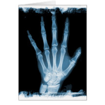 Blue X-ray Skeleton Hand Cards