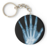 Blue X-ray Skeleton Hand keychains