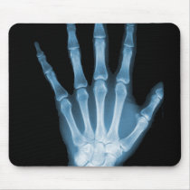 Blue X-ray Skeleton Hand Mousepad