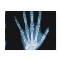 Blue X-ray Skeleton Hand Post Cards