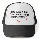 Boils hats