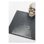 BonesXray061209 stationery