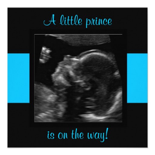 Boy Baby Customized Ultrasound Photo Template Invitation