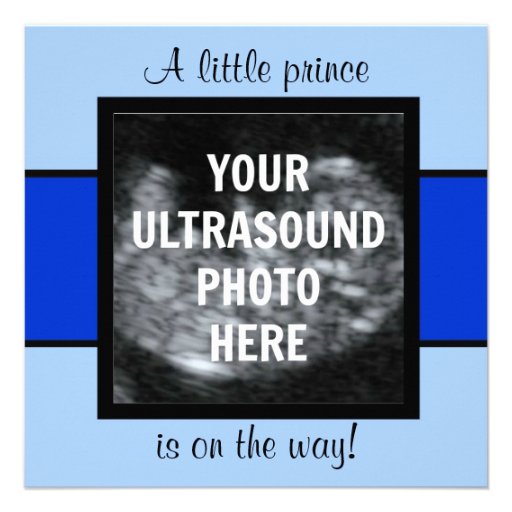 Boy Baby Customized Ultrasound Photo Template Personalized Invitations