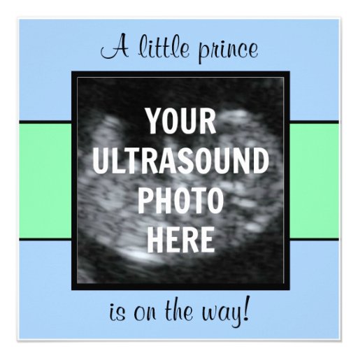 Boy Baby Customized Ultrasound Photo Template Custom Invitation