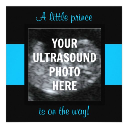 Amazon.com: Baby Shower Invitation with Ultrasound Sonogram Photo ALL ...