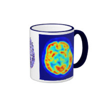 Brain image mugs