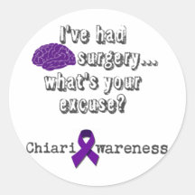 Brain Surgery Round Stickers
