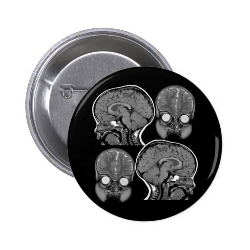 BRAINS! (MRI) BUTTON