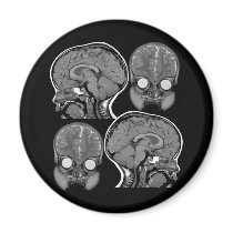 BRAINS! (MRI) REFRIGERATOR MAGNETS