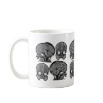 BRAINS! (MRI) mugs by Dynomoose BRAINS! (MRI) mugs