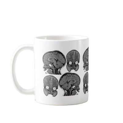 BRAINS! (MRI) COFFEE MUG by Dynomoose