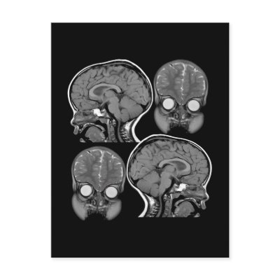 BRAINS! (MRI) POSTCARD by Dynomoose