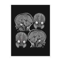 BRAINS! (MRI) POSTCARD