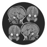 BRAINS! (MRI) ROUND STICKERS