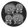 BRAINS! (MRI) ROUND STICKERS