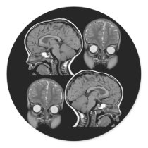BRAINS! (MRI) stickers