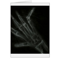 Broken Hand X-ray Greeting Cards
