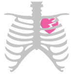 Broken Heart in Ribcage Photo Sculpture