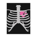 Broken Heart in Ribcage Postcard