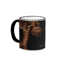 Brown/Gold C-spine (double image) mug