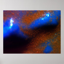 CARDIAC RYTHYM POSTER