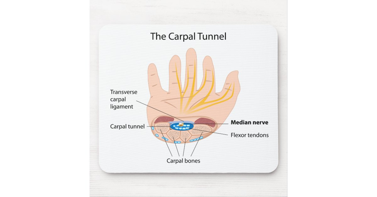 Carpal tunnel syndrome Mousepad Zazzle