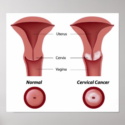 Anatomy Of Cervix