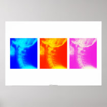 Cervical X-ray Chiropractic poster 2 posters