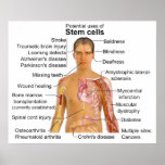 Chart of Potential Uses for Stem Cell Treatments posters