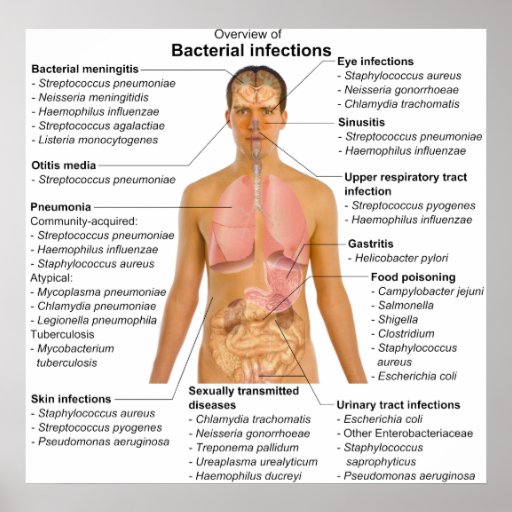 Chart Of The Main Bacterial Infections In Humans Poster Zazzle