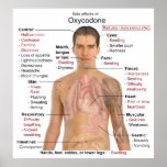 Chart of the Main Side Effects of Oxycodone posters