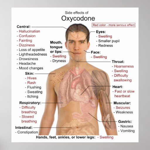 Chart of the Main Side Effects of Oxycodone Poster Zazzle