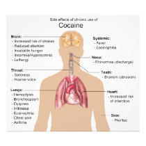 Chart of the Side Effects of Chronic Cocaine Use Photo