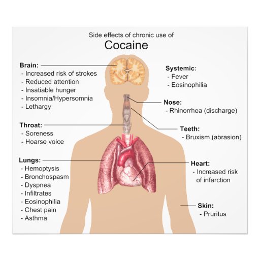 Chart of the Side Effects of Chronic Cocaine Use Photo Zazzle