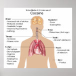 Chart of the Side Effects of Chronic Cocaine Use Print