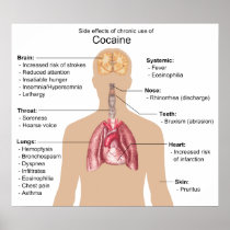 Chart of the Side Effects of Chronic Cocaine Use Print