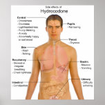 Chart of the Side Effects of Opioid Hydrocodone posters