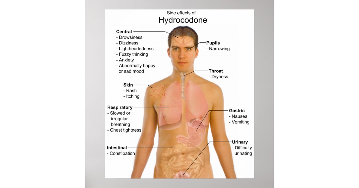 Chart of the Side Effects of Opioid Hydrocodone Poster Zazzle
