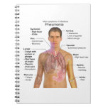 Chart of the Symptoms of Pneumonia Note Book