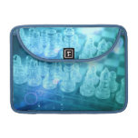 Chess Match 13" MacBook Sleeve MacBook Pro Sleeve