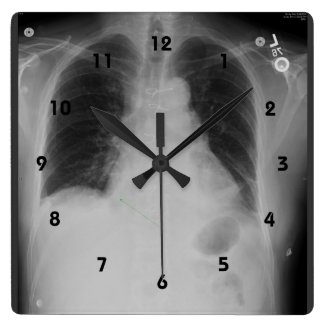 Chest X Ray ~ Clock