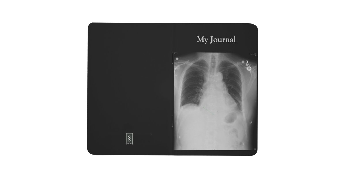 Chest X Ray Journal Zazzle