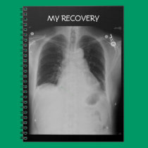Chest X Ray ~ Notebook notebooks