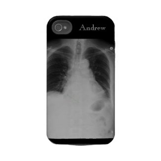 Chest X Ray w name ~ iPhone 4 CaseMate Tough case