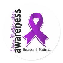 Chiari Malformation Awareness 5 Round Stickers