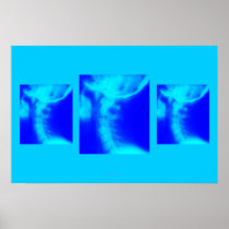 Chiropractic Poster: Lateral Cervical Blues posters