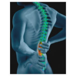 Chiropractor Business Flyer