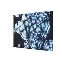 Cholesterol Crystals Viewed in Polarized Light Canvas Print